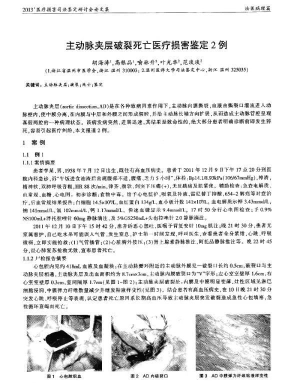 主动脉夹层破裂死亡医疗损害鉴定2例