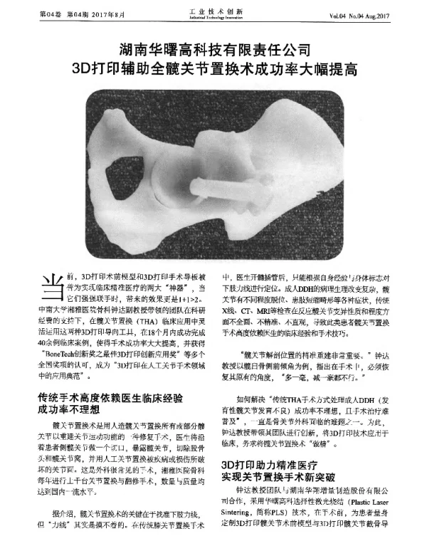湖南华曙高科技有限责任公司3D打印辅助全髋关节置换术成功率大幅提高